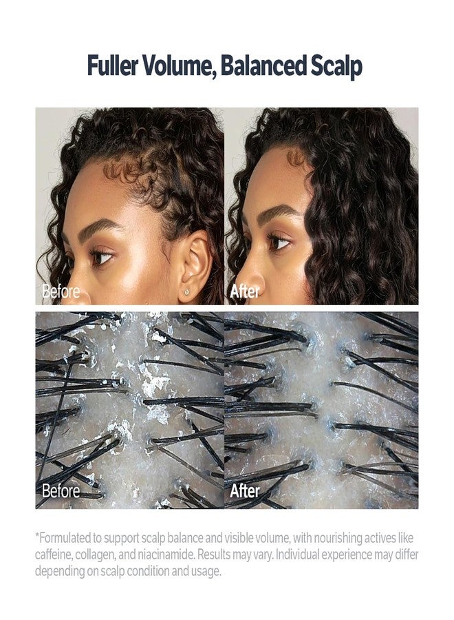 SUNGBOON EDITOR Deep Collagen Retinol Scalp Serum |Roll-On Hair Growth&Thickening Serum |Dry, Itchy Scalp Treatment |Caffeine +Biotin +Rosemary |Korean Hair Care,0.5 fl oz - Image 4